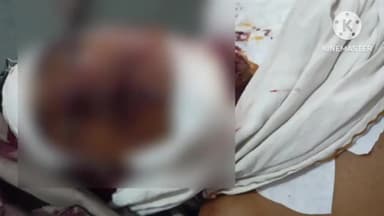 आगर: शिवाय होटल के सामने सड़क दुर्घटना में 25 वर्षीय बाइक सवार युवक की हुई मौत, आगर अस्पताल में कराया गया शव का पोस्टमार्टम