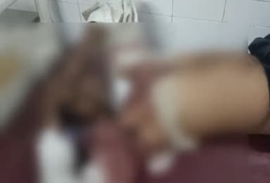 बहराइच: चमारनपुरवा में रिक्शा सवार शख्स की गर्दन में घुसा बांस, घायल का इलाज जारी