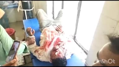 गोंडा: सहजनवा गांव के पास गोंडा बहराइच मार्ग पर बाइक की टक्कर से युवक हुआ घायल, जिला अस्पताल रेफर