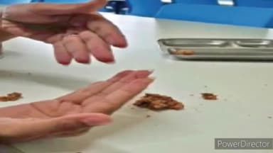 हुज़ूर: एमसीयू के गर्ल्स हॉस्टल के खाने में निकली इल्ली, छात्राओं में आक्रोश