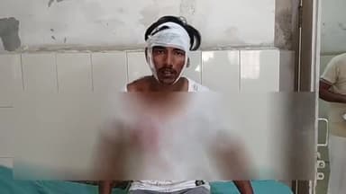 हांसी: रूपनगर कॉलोनी में एक युवक पर अज्ञात ने चाकुओं से हमला कर किया घायल, जांच में जुटी पुलिस