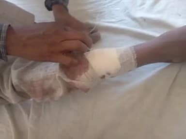 रायबरेली: शांति नगर में दोस्त पर कातिलाना हमला करने के आरोप में हिस्ट्रीशीटर अपराधी पर मुकदमा दर्ज