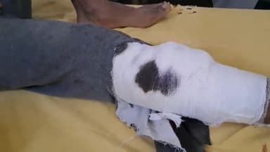 बुलंदशहर: थाना कोतवाली देहात के पास टेम्पो से टकराकर बाइक सवार हुआ गंभीर रूप से घायल