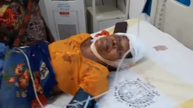 सासाराम: पीयरो छत पर से गिरकर गंभीर रूप से घायल हुई एक महिला, इलाज के लिए सदर अस्पताल में कराया गया भर्ती।