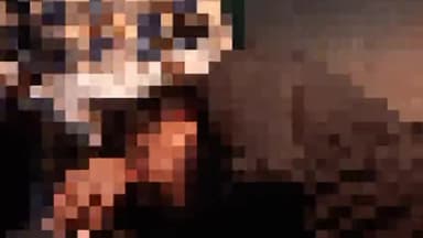 बलियापुर: कर्माटांड़ मोड़ के पास सड़क दुर्घटना में एक युवक हुआ घायल, उपचार जारी