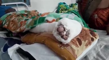 नरसिंहपुर: अम्बेडकर वार्ड निवासी व्यक्ति को सोनी धर्मशाला के पीछे ऑटो ने मारी सामने से टक्कर, पैर में आई गंभीर चोट