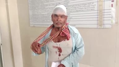 रॉबर्ट्सगंज: हिंदूवारी के पास अज्ञात 3 लोगों ने एक व्यक्ति को बुरी तरह से पीटा, व्यक्ति हुआ घायल