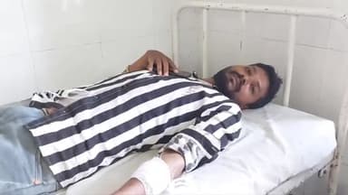बैतूल: उड़दन में ढाबा संचालक को महिला ने चाकू से वार कर किया घायल, जिला अस्पताल में कराया गया भर्ती