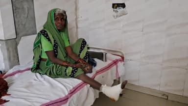 खुरई: भरछा गांव में चलती हुई बाइक में महिला का फसा पैर, महिला हुई घायल अस्पताल में कराया गया भर्ती