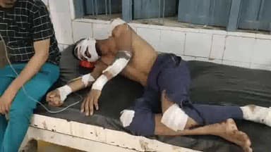 आरा: देवढ़ी के पास नीलगाय बीच में आने से बाइक सवार युवक हुआ घायल