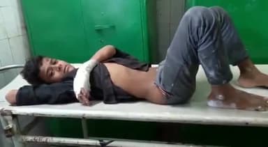 रामनगर में जर्जर मकान का छज्जा गिरने से तीन किशोर घायल, चल रहा इलाज