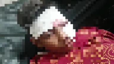 सिरोंज: कांकड़ खेड़ी की घाटी पर दो बाइकों के बीच हुई टक्कर, 3 युवक हुए घायल