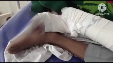 करेली: ग्राम धमना निवासी बुजुर्ग पर जंगली जानवर ने किया हमला, बुजुर्ग को घायल अवस्था में जिला अस्पताल में कराया गया भर्ती