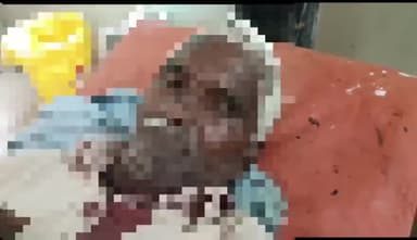 कन्नौज: हर्रा गांव में जमीनी विवाद में भतीजे ने अपने चाचा के सिर पर धारदार हथियार से किया हमला