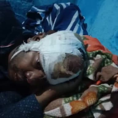 हरलाखी: उमगांव में आंधी तूफान के दौरान अल्बेस्टर छत उड़ने से शौच करने जा रहा एक युवक हुआ जख्मी