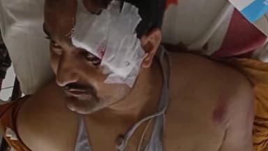 सोनपुर: सोनपुर जेपी सेतु सड़क मार्ग पर स्कॉर्पियो चालक ने एक मोटरसाइकिल सवार को ठोकर मारकर किया घायल