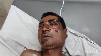 लाडपुरा: 2 मोटरसाइकिलों की भिड़ंत में बाइक सवार बुंदी निवासी दम्पत्ति घायल पति की हालत गम्भीर MBS अस्पताल में भर्ती