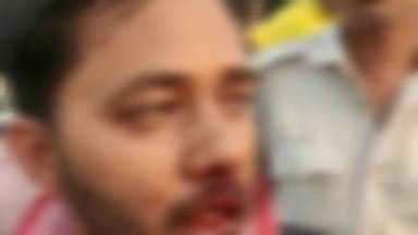 कांके: पंडरा बाजार परिसर में ज्यादा पैसे मांगने का विरोध करने पर मज़दूरों ने एक युवक को पीटा