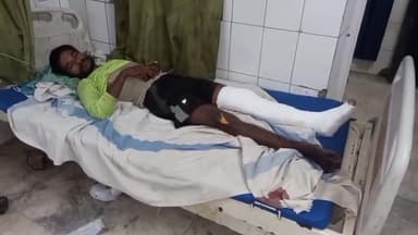 कहरा: कोसी बांध मोर के समीप बच्चे को बचाने के चक्कर में गिरा बाइक चालक हुआ जख्मी, सहरसा सदर अस्पताल में भर्ती