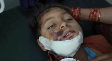 छतरपुर नगर: ग्राम कैंडी में छत से गिरने से मासूम हुआ बुरी तरह से घायल, उपचार के लिए छतरपुर जिला अस्पताल में कराया गया भर्ती