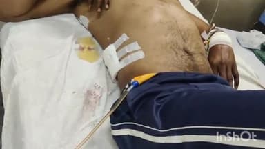 लाडपुरा: बारां में मोटरसाइकिल अड़ने के विवाद में 2 व्यक्तियों पर चाकू व तलवारों से हमला, दोनों घायल