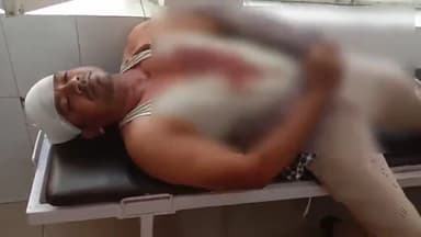 मुरादाबाद: गलशहीद क्षेत्र में घर के आगे बाइक खड़ी करने पर दो पक्षों में हुई जमकर मारपीट, एक व्यक्ति गंभीर रूप से हुआ घायल