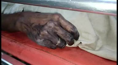 छतरपुर नगर: वमीठा में 55 वर्षीय व्यक्ति ने डाई का किया सेवन, जिला अस्पताल में भर्ती