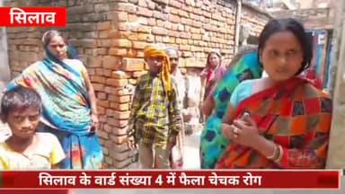 सिलाव: सिलाव के वार्ड संख्या 4 के माली टोला में फैला चेचक रोग, अब तक 15 से अधिक लोग अक्रांत