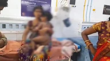 जमुई: कोनन गांव में गरम पानी की चपेट में आने से एक बच्चा झुलसा, सदर अस्पताल में करवाया गया भर्ती