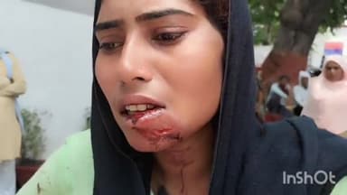 सलोन: खमरिया पूरे कुशल में बकरी दरवाजे पर जाने के विवाद में दो पक्षों में हुई मारपीट, कोतवाली पुलिस ने मुकदमा किया दर्ज