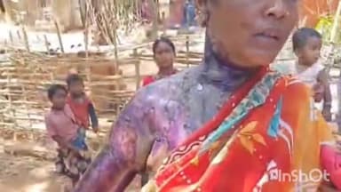 बस्तर: कोहकापाल में महिला खाना बनाने के दौरान चूल्हे में गिरने से गंभीर रूप से हुई घायल,108 से पहुंचाया महारानी अस्पताल