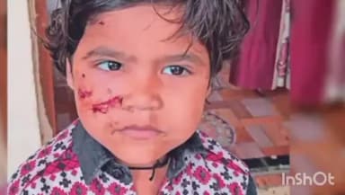रतलाम नगर: जवाहर नगर में घर के बाहर खेल रही 3 वर्षीय बालिका पर कुत्ते ने किया हमला घायल बालिका को किया जिला अस्पताल भर्ती