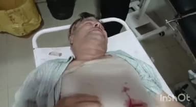 मुरादाबाद: जामा मस्जिद के पास रास्ते को लेकर दो पक्षों में हुए विवाद में एक व्यक्ति घायल, जिला अस्पताल में भर्ती