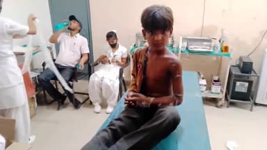 जहानाबाद: छरियारी गांव में ऊंचे दीवाल पर चढ़कर खेलना एक किशोर को पड़ा मंहगा, गिरने से हुआ गंभीर रूप से घायल टूटा एक हाथ।