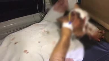 अनूपशहर: कोतवाली क्षेत्र के बुलंदशहर मार्ग पर अज्ञात वाहन ने कार को पीछे से मारी टक्कर, 3 लोग हुए गंभीर रूप से घायल