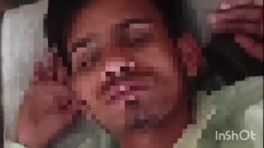 हसनपुर: हसनपुर-रहरा मार्ग मंगरौला गांव के नजदीक बाइक सवार को सामने से आ रही कार ने मारी जोरदार टक्कर, बाइक सवार युवक हुआ घायल