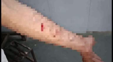 छतरपुर नगर: जीवन ज्योति कॉलोनी में प्लॉट पर रंगदारी न देने पर गुंडो ने धारदार हथियार से व्यक्ति पर किया हमला सिविल लाइन थाने में दो