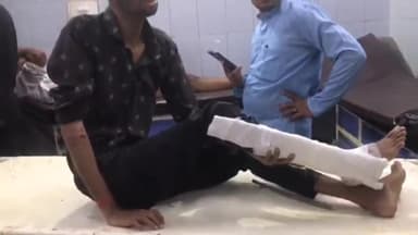 अनूपशहर: क्षेत्र के शिवाली गांव के निकट अज्ञात वाहन ने बाइक सवार युवकों में पीछे से मारी टक्कर, 2 युवक हुए गंभीर रूप से घायल