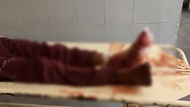 अनूपशहर: कोतवाली क्षेत्र के गुरावली गांव के निकट अज्ञात वाहन ने बाइक सवार युवक को पीछे से मारी टक्कर, युवक गंभीर रूप से हुआ घायल