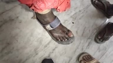 गोपालगंज: श्रीरामपुर गांव में घर के बाहर खेलने के दौरान किशोर को जहरीले सांप ने काटा, इलाज के लिए सदर अस्पताल में भर्ती