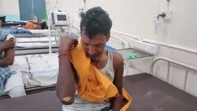 बिहार: दामोदरपुर बलहा गांव में गाली-गलौज का विरोध करने पर हुई मारपीट में 4 लोग हुए घायल, लाया गया सदर अस्पताल