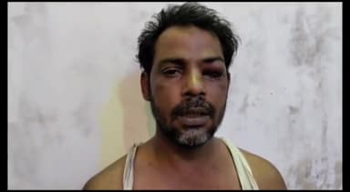 मेरठ: चमड़ा पैठ पर उधार दिए पैसे वापस मांगने पर व्यक्ति और उसके परिवार के साथ की गई मारपीट, पुलिस से की शिकायत