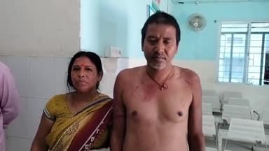 बिहार: तूंगी गांव में गोतिया के बीच हुआ मारपीट, दोनों पक्ष से 3 लोग हुए जख्मी