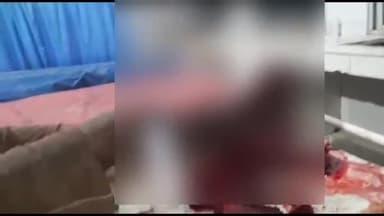 अररिया: मानिकपुर एबीसी नहर के समीप रोलर की चपेट में आने से साइकिल सवार हुआ घायल, सदर अस्पताल में भर्ती