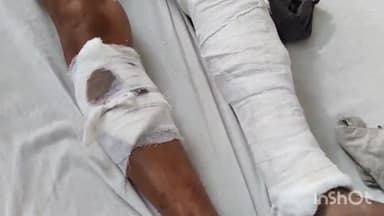 लाडपुरा: जमीन विवाद में बनेठा थाना क्षेत्र के चतानी गांव में बुजुर्ग व्यक्ति पर लाठी व सरियों से हमला MBS अस्पताल में भर्ती