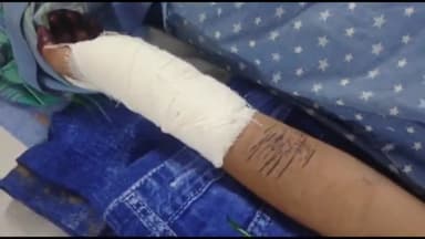 करेली: युवक द्वारा प्रताड़ित करने पर करेली निवासी युवती ने काटी हाथ की नश, जिला अस्पताल में किया गया भर्ती