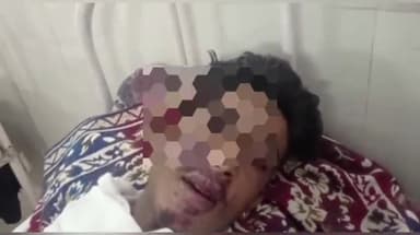 नरसिंहपुर: बोहानी के पास अज्ञात फॉर व्हीलर ने बाइक सवार 2 किशोरों को मारी टक्कर, दोनों घायलों का जिला अस्पताल में उपचार जारी