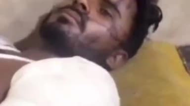 आलापुर: सरजू नगर के निकट स्कॉर्पियो की चपेट में आने से बाइक सवार युवक गंभीर रूप से हुआ घायल