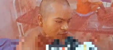 मुशहरी: प्यार करने के बहाने पेड़ से बांधकर पति को जिंदा जलाया, एसकेएमसीएच में कराया गया भर्ती