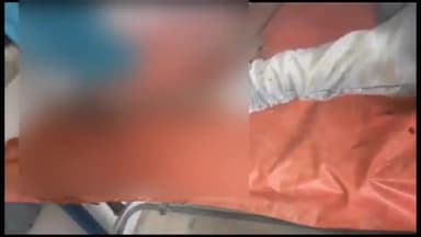 अररिया: बैरगाछी में ताड़ के पेड़ से गिरकर एक युवक हुआ घायल, इलाज के लिए सदर अस्पताल में भर्ती